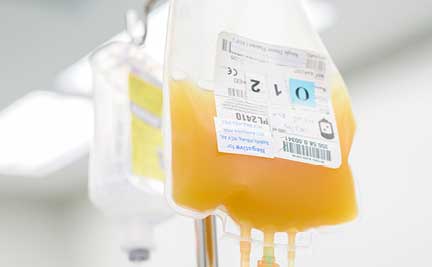 A bag of platelets hangs for a transfusion