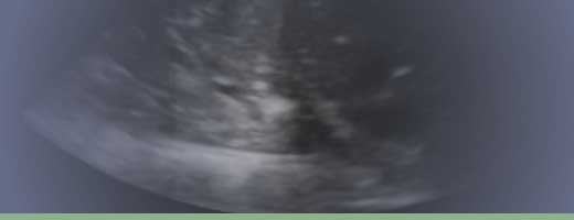 Critical Care Ultrasonography image