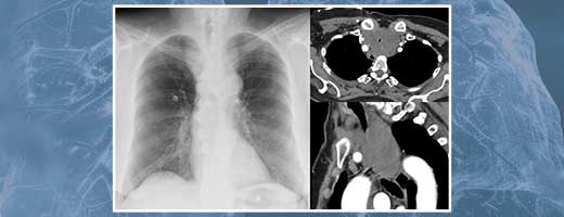 Management of central airway obstruction guideline imagery