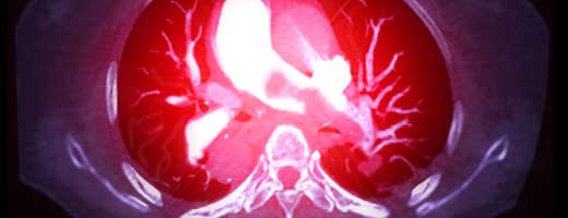 Critical Care Board Review On Demand